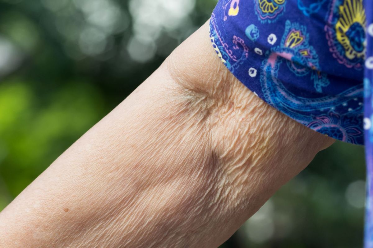 Detalle de la piel del antebrazo